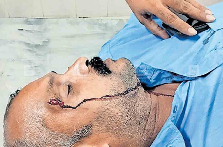  കെഎസ്ആർടിസി ഡ്രൈവറെ കാറിലെത്തിയ സംഘം ഡിപ്പോയിൽ കയറി മർദിച്ചു