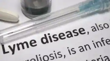  അപൂർവരോഗമായ ‘ലൈം രോഗം’ എറണാകുളത്ത് റിപ്പോർട്ട് ചെയ്തു