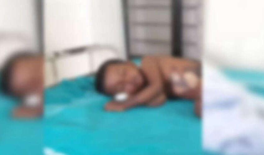  മൂന്നു വയസ്സുകാരന് നേരെ കൊടും ക്രൂരത: തിളച്ച ചായ ദേഹത്ത് ഒഴിച്ചു