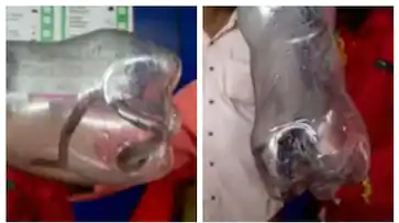  മകളുമായി സർക്കാർ ആശുപത്രിയിലെത്തിയ അമ്മയ്ക്ക് പാമ്പുകടിയേറ്റു