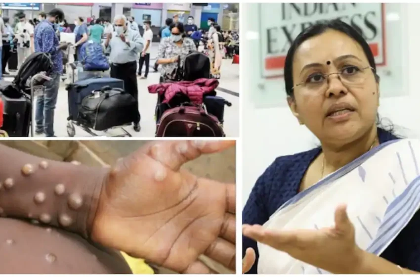  വിദേശത്ത് നിന്നെത്തുന്നവർക്ക് കർശന നിർദ്ദേശങ്ങൾ;എം പോക്സ് ലക്ഷണങ്ങളുണ്ടെങ്കിൽ ചികിത്സ തേടണം