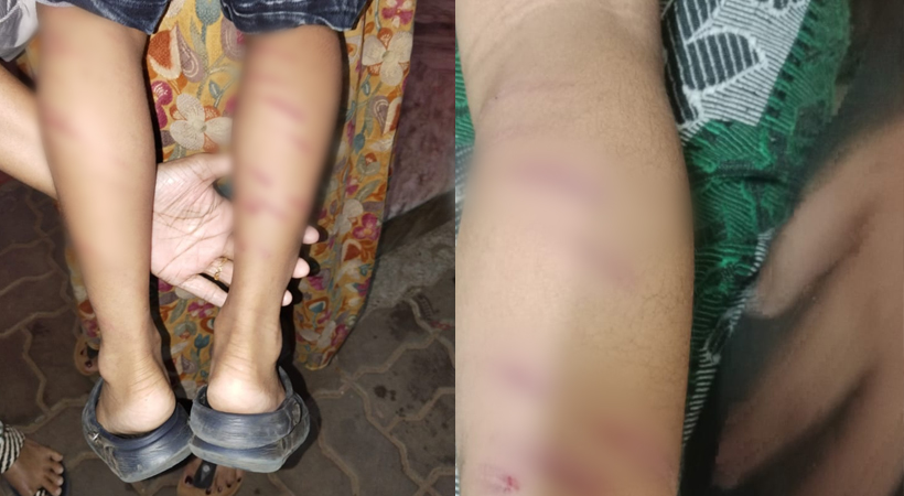  അഞ്ച് വയസുകാരനെ ക്രൂരമായി മര്‍ദിച്ച സംഭവത്തിൽ അധ്യാപിക അറസ്റ്റിൽ