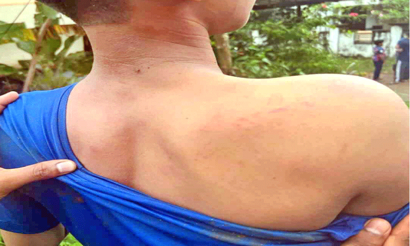  യു​വാ​ക്ക​ൾ ചേ​ർ​ന്ന് വി​ദ്യാ​ർ​ഥി​യെ ക്രൂ​ര​മാ​യി മ​ർ​ദി​ച്ചു